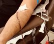מחסור חמור בדם בישראל - בבתי החולים דוחים ניתוחים